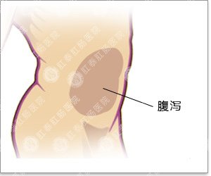 经常拉肚子是怎么回事