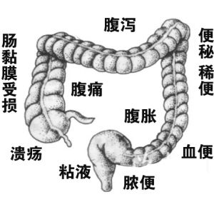 肠炎一般都是什么原因引起的