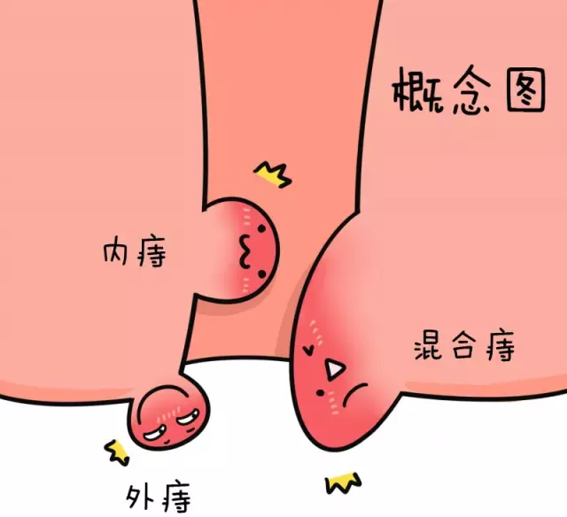 内痣有哪些症状表现