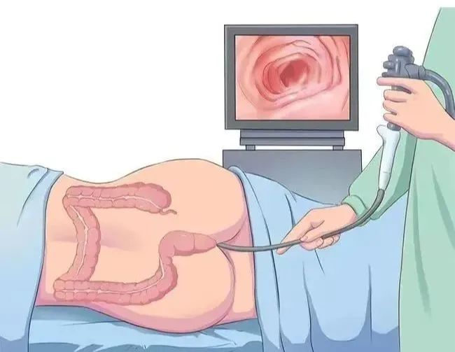 世界肠道健康日｜关爱胃肠，守护健康